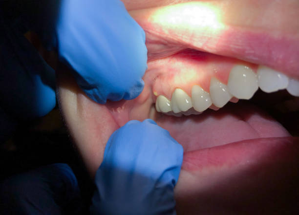 Best 24-Hour Emergency Dental Care in Mayflower, AR